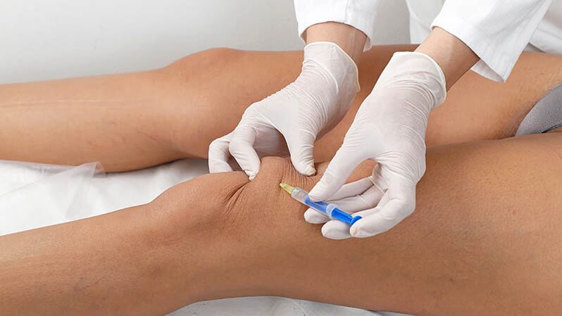 Intracecular injection for knee arthrosis